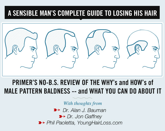 A Sensible Man’s Complete Guide to Losing His Hair