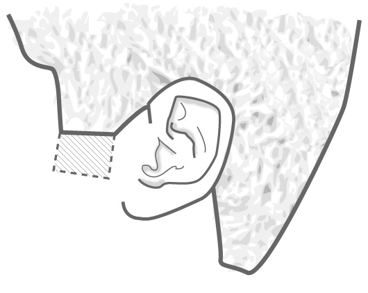 Illustration of side burn length going to mid-ear