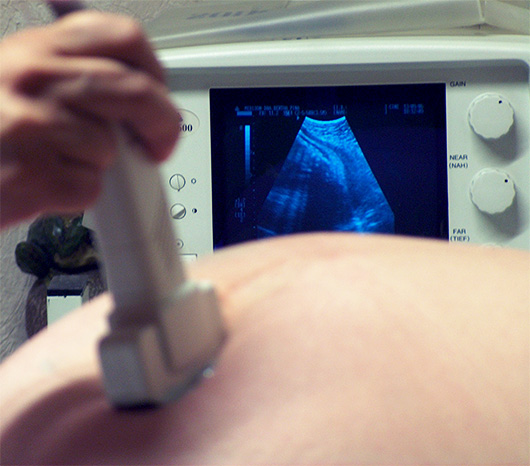 Pregnancy and Ultrasound